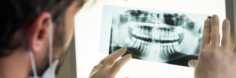 Zahnarzt schaut sich ein Röntgenbild vom einem Gebiss an