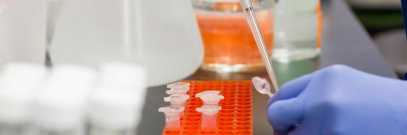 Ein Laborant träufelt eine Flüssigkeit in ein kleines Gefäß